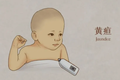 新生宝宝黄疸怎么退的快 婴儿黄疸消退只用四招