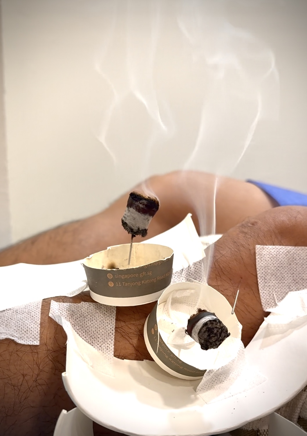 膝盖疼痛怎么办？新加坡治膝关节疼痛最厉害的中医是谁？