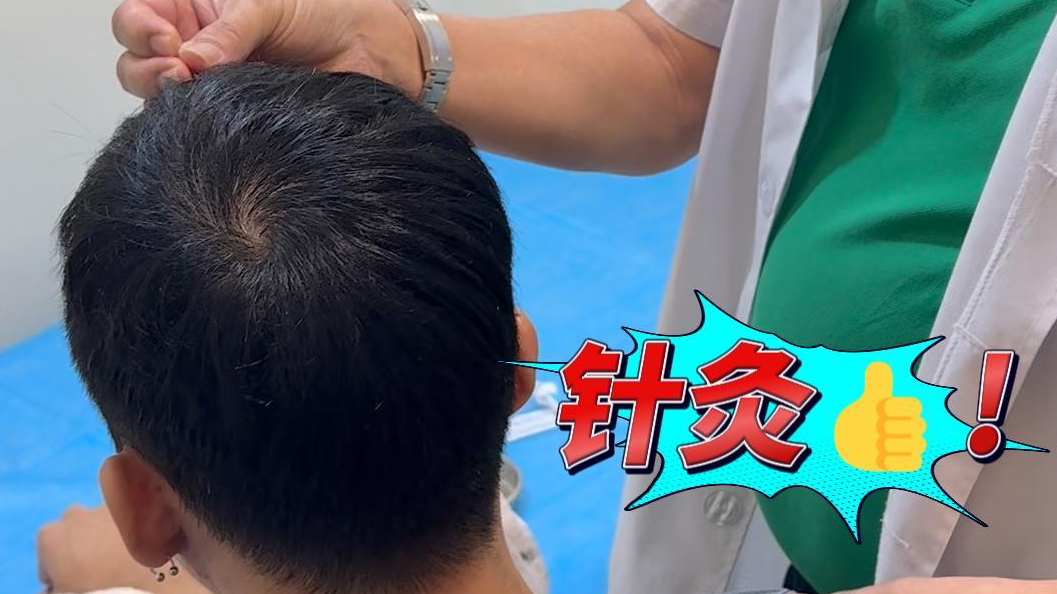 三叉神经痛怎么办？新加坡看疼痛病的中医哪家好？